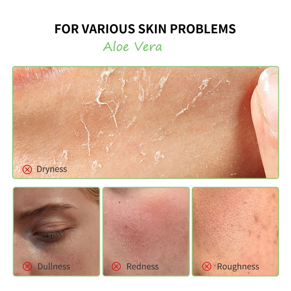 Multi-skin Care Aloe Vera Skin Care Set Deep Moisturizing Deep Nourishment Whitening Brightening Hydrating Smooth Skin Peaceful Pleasures Health and Wellness