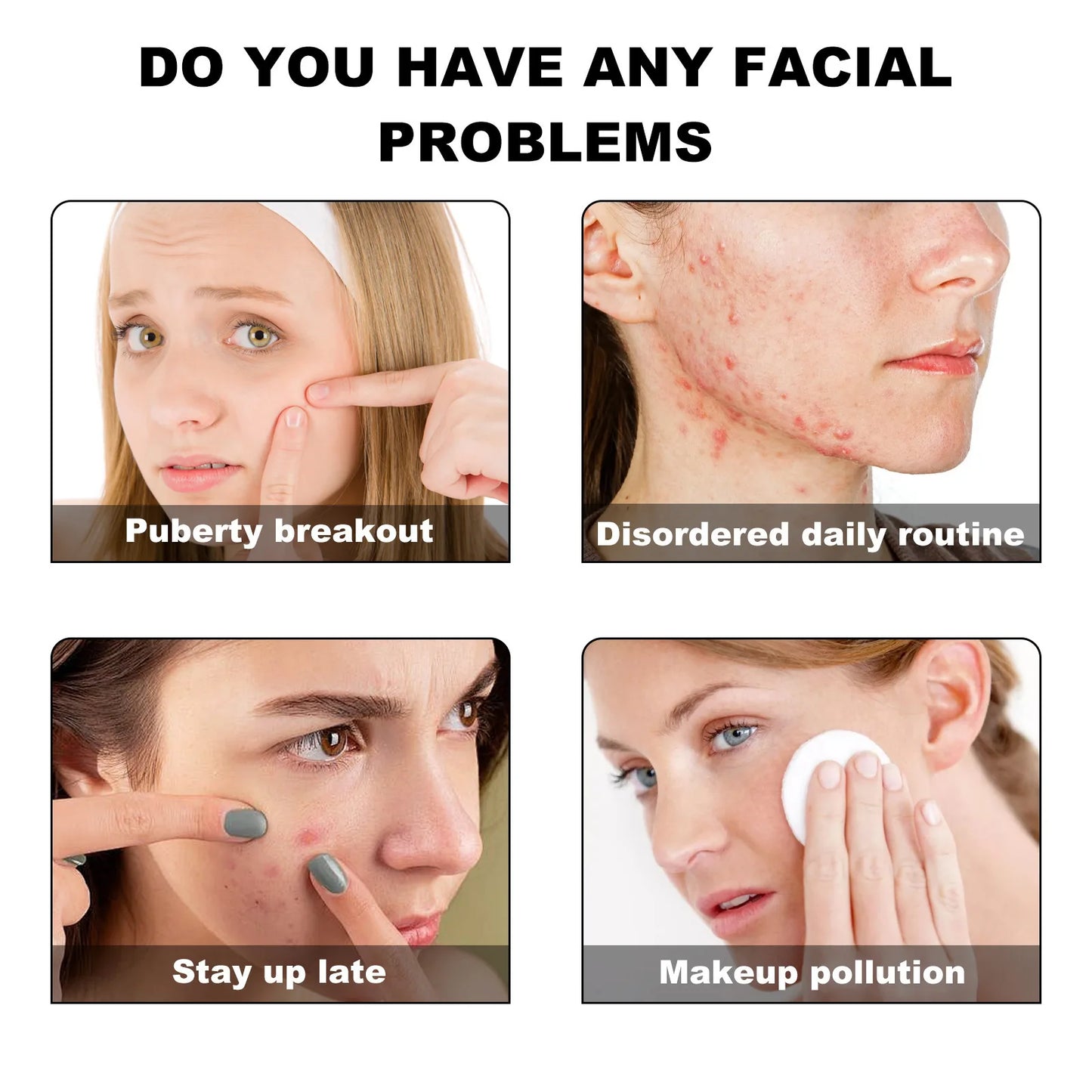 Acne Treatment Patch Absorbing Acne Cover Blemish Anti Infection Waterproof Spot Marks Concealer Colorful Pimple Removal Sticker Peaceful Pleasures Health and Wellness