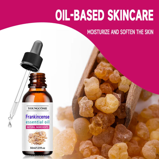Frankincense Essential Oil – Scalp, Hair & Aromatherapy Hair & Scalp Oil Oasis Select