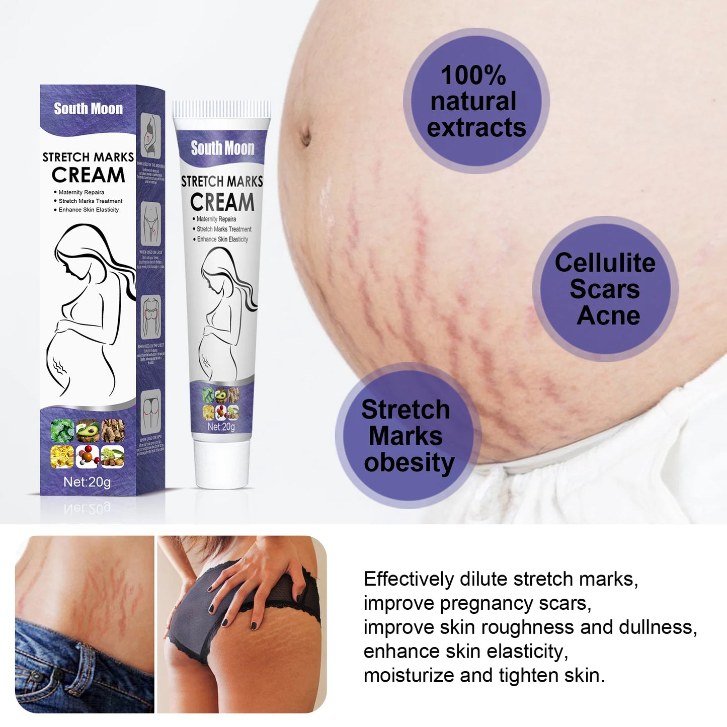 Pregnancy Stretch Mark Cream – Vitamin E, Firm & Smooth Skin