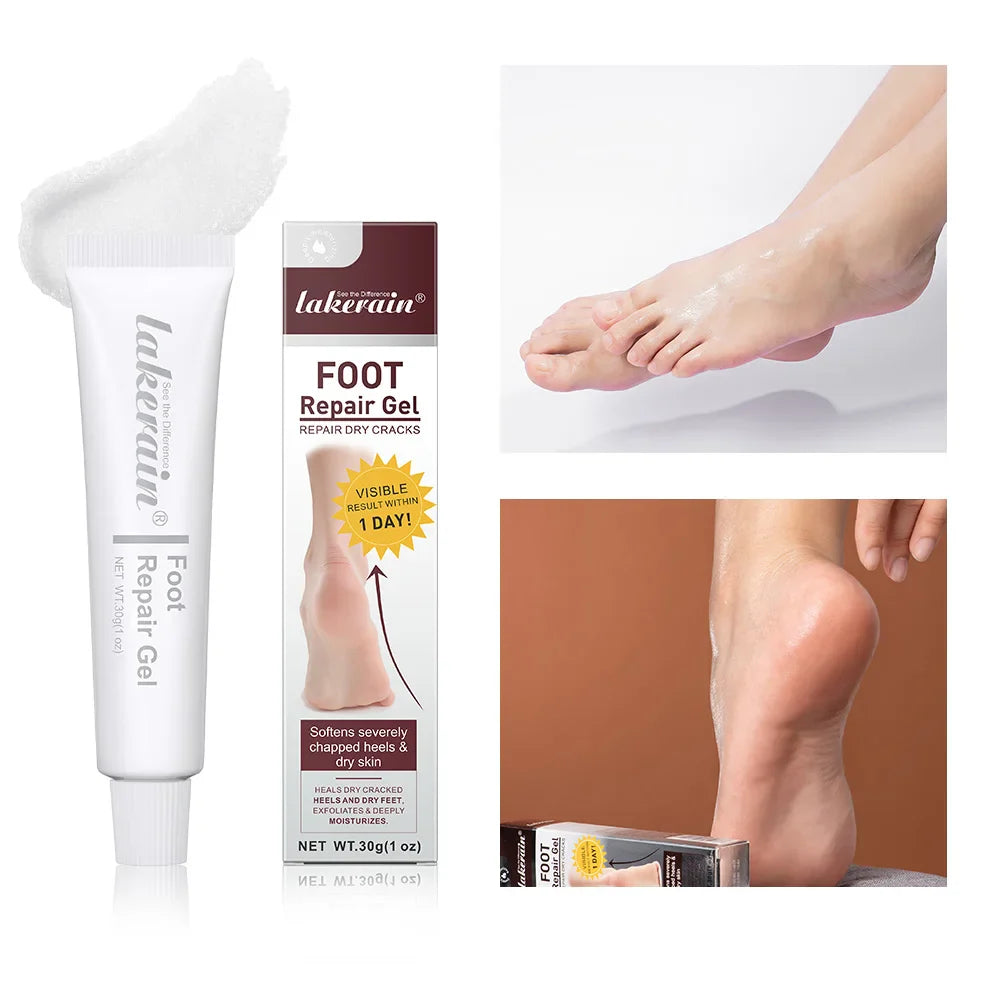 Foot & Hand Repair Gel Cream – Exfoliating Moisturizer 30g