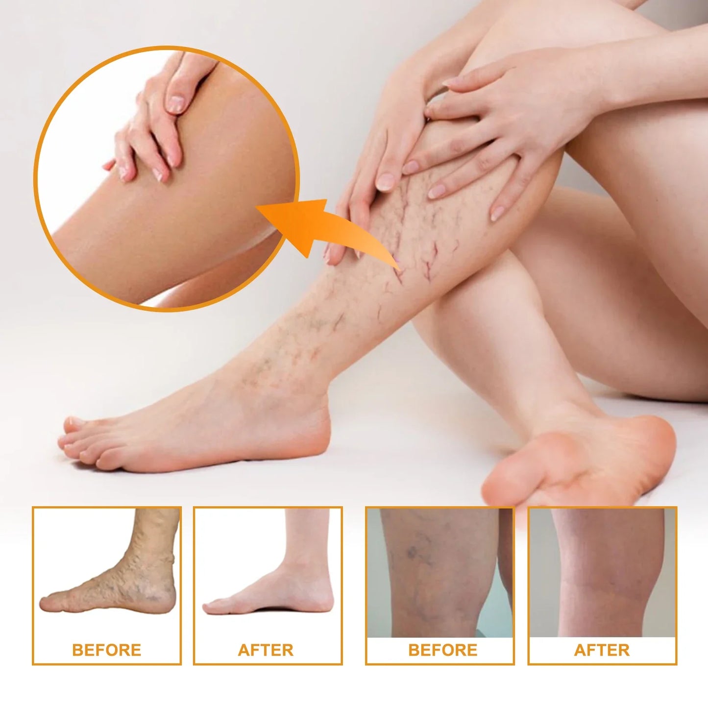 Vitamin K Leg Massage & Skin Care Cream 60g – Daily Moisturiser