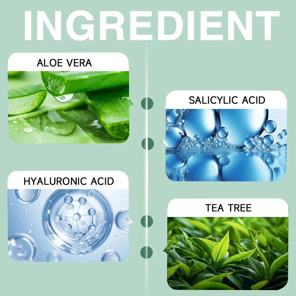 Urea 40% Foot & Hand Cream – Callus Softener | YOUNGCOME