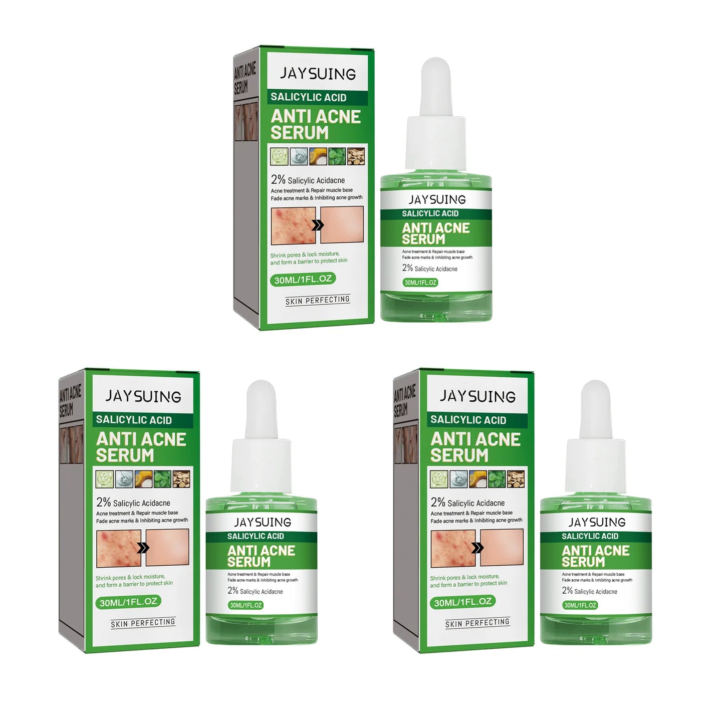 Salicylic Acid Acne Face Serum – Pores, Blackheads & Oil