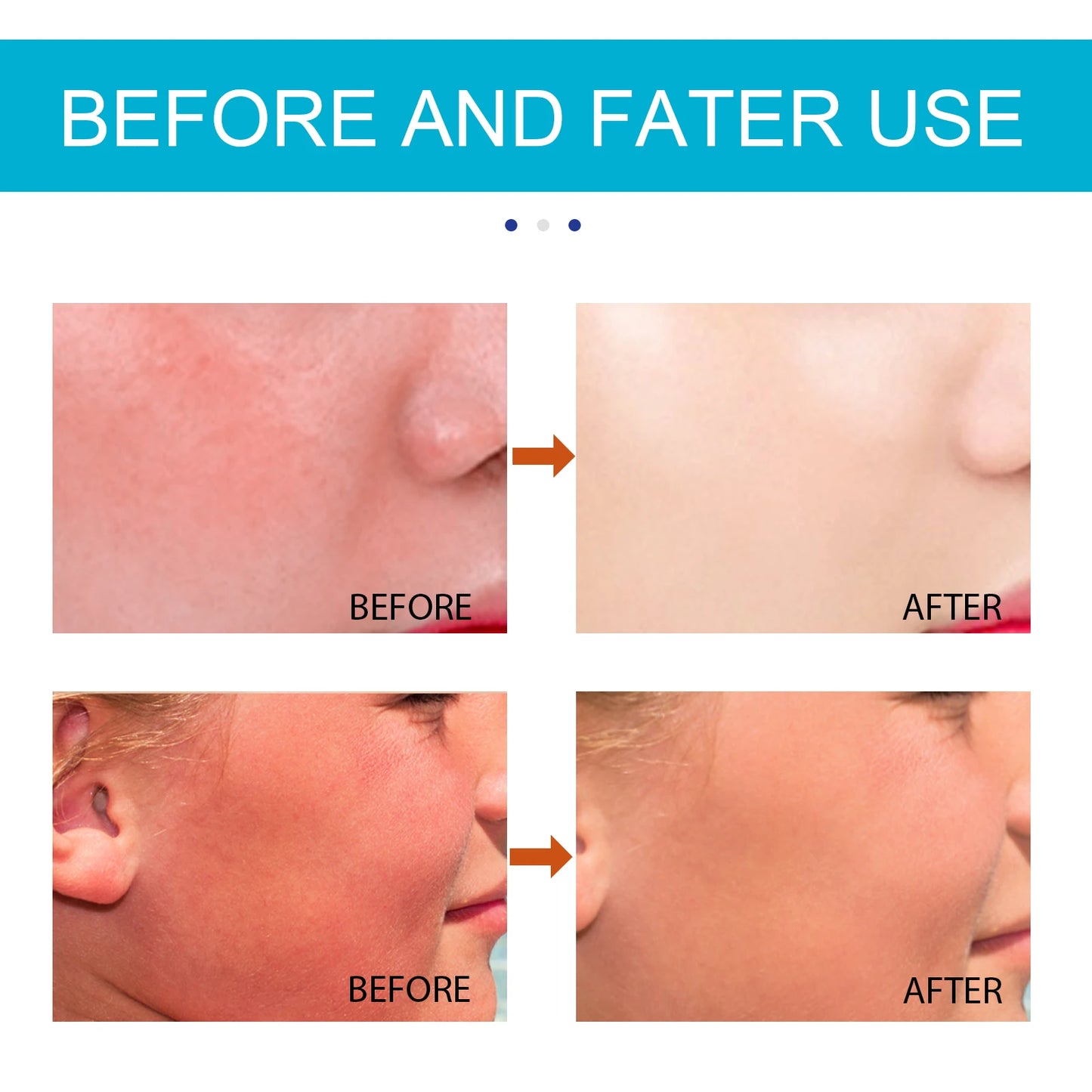 Jaysuing SPF 50+ Sunscreen Stick – UV Protection & Moisturizing