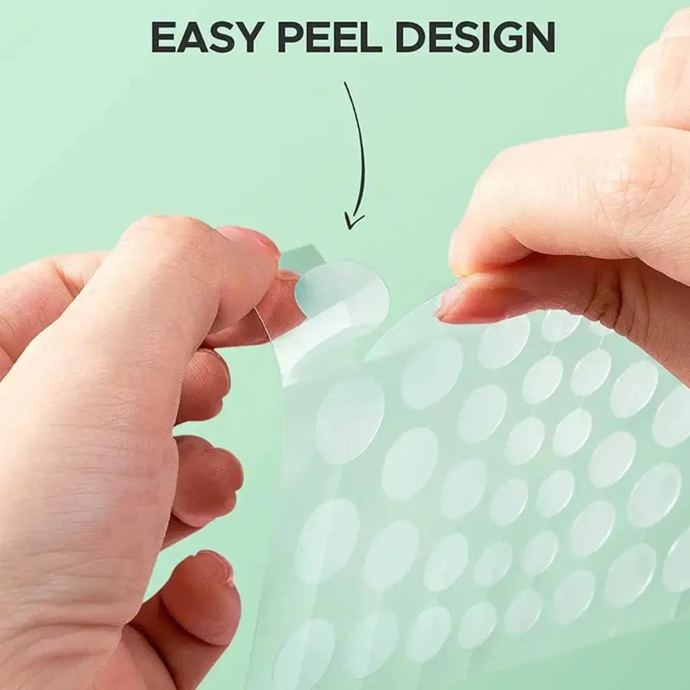 30pcs Hydrocolloid Acne Pimple Patch for Repair Peaceful Pleasures Health and Wellness