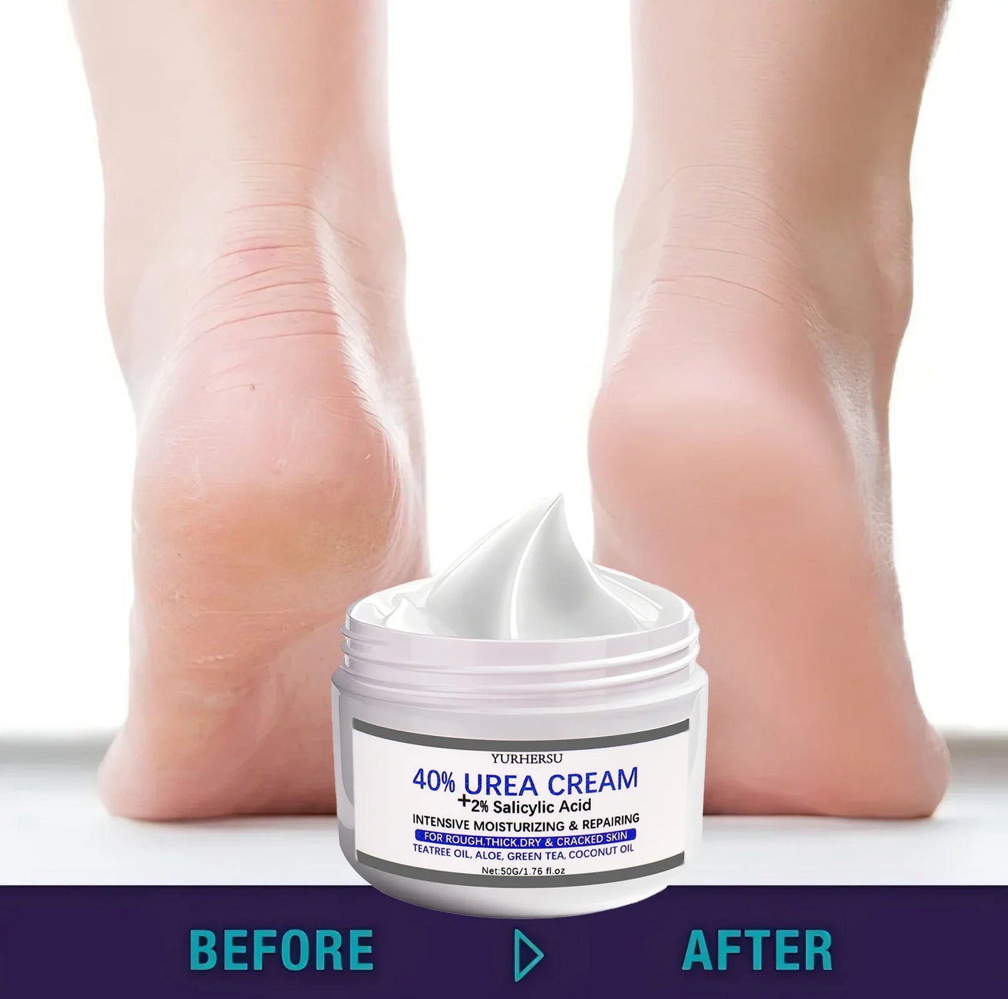 YURHERSU 40% Foot Cream – Exfoliating Dry & Cracked Heels