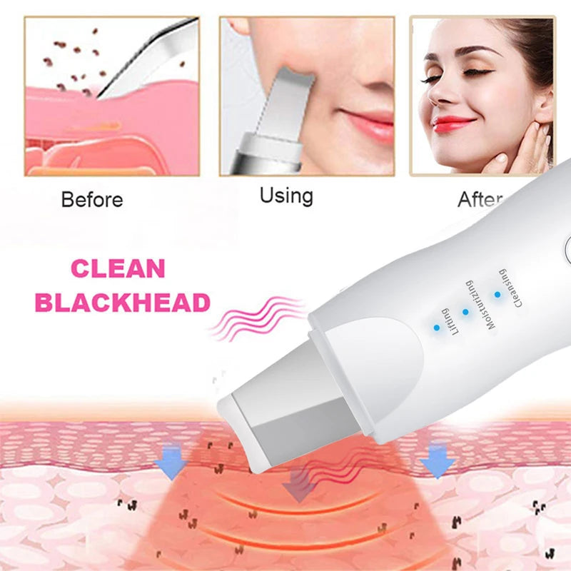 Ultrasonic Skin Facial Cleaner Blackhead Removal Pore Scrubber Face Scrubber with Peeling Feature Beauty & Personal Care Product Peaceful Pleasures Health and Wellness