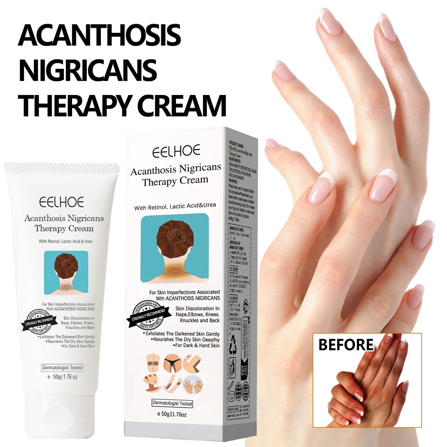 EELHOE Skin Brightening Whitening Cream – Neck, Elbow & Body