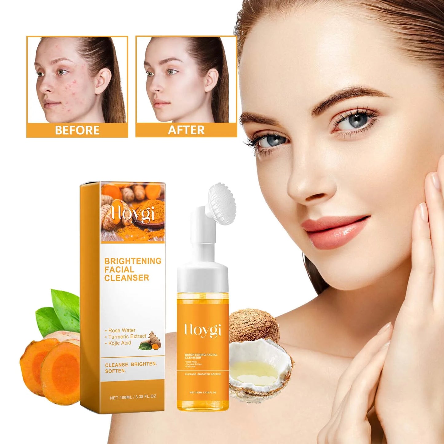 HOYGI Turmeric Kojic Acid Foaming Cleanser – Acne & Brightening