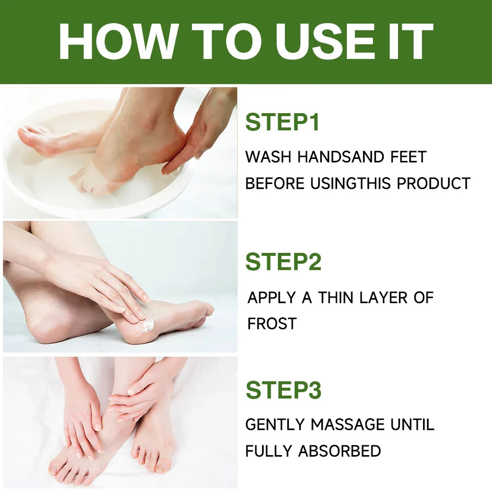 YOUNGCOME Lemon Foot Cream – Heel Repair & Moisturizer 60g