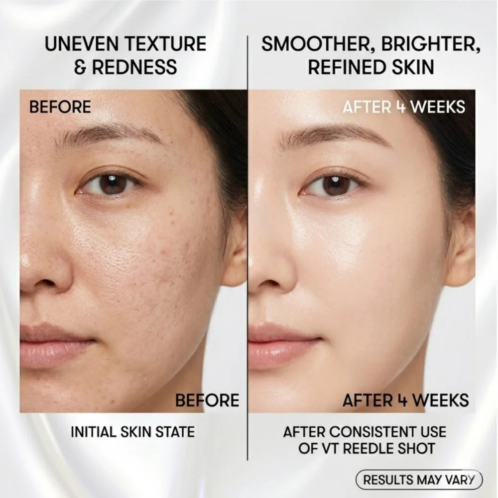 Microneedle Eye Cream | Brightening Firming Microcrystalline