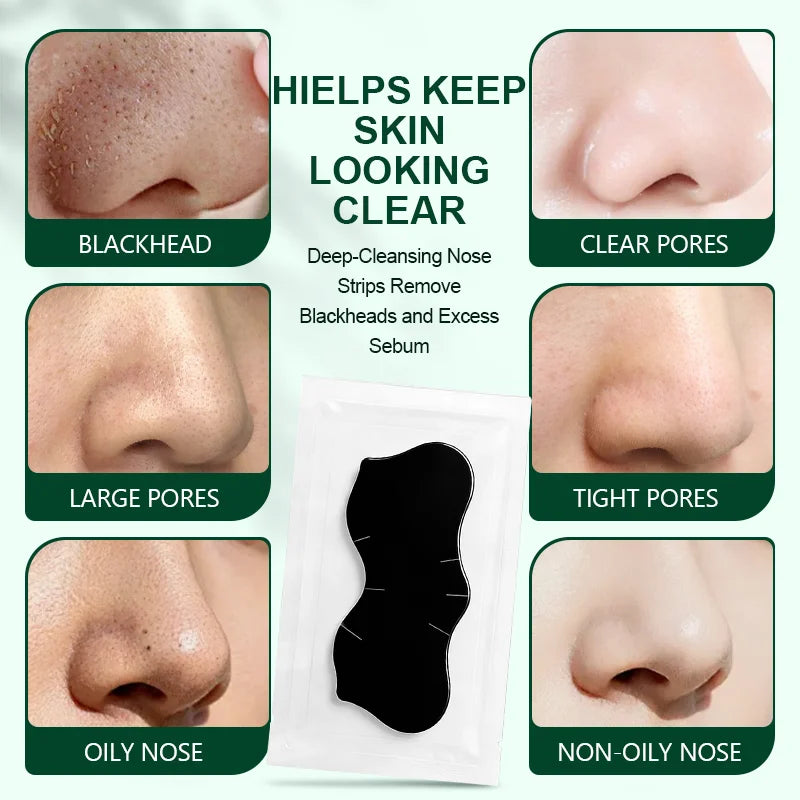 Blackhead Remover Strip, Nose Strips Blackhead Remover for Men and Women, Charcoal Pore Strips, Deep Cleansing and Oil Control Peaceful Pleasures Health and Wellness