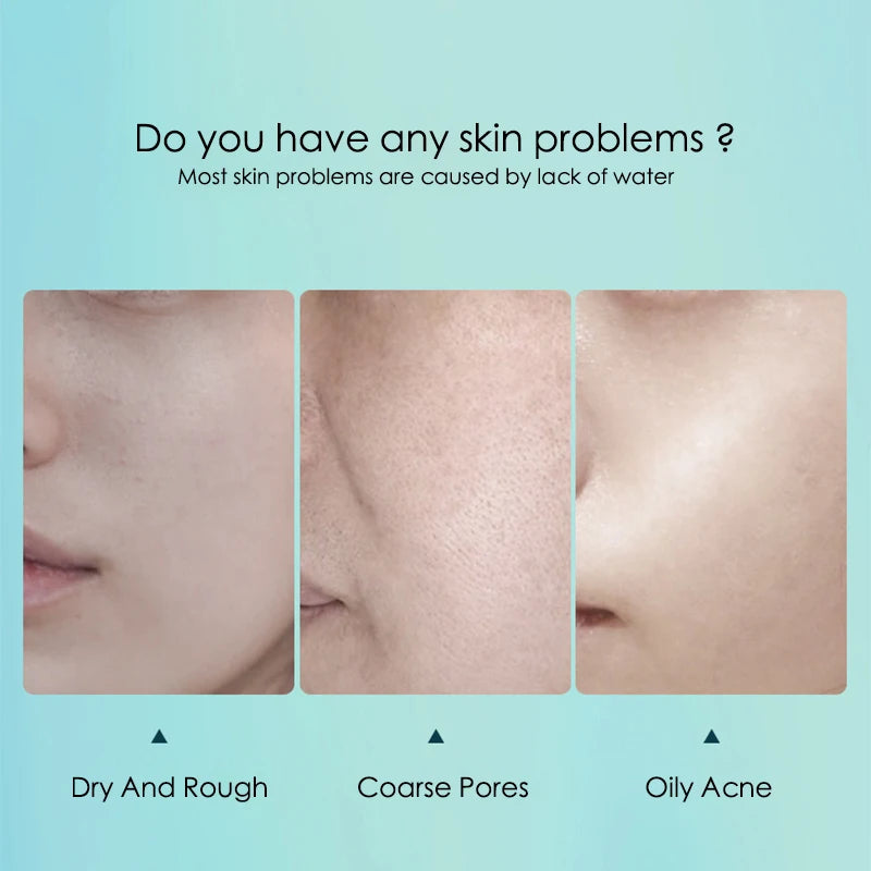 BIOAOUA Hyaluronic Acid Sheet Mask 10pc | Hydrate & Shrink Pores