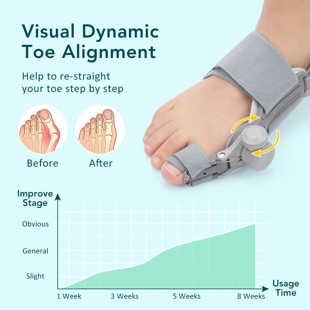 Bunion Corrector Big Toe Hallux Valgus Foot Brace Angle Adjuster Bone Thumb Straightener Orthopedic Strap Pedicure Care Tool Peaceful Pleasures Health and Wellness