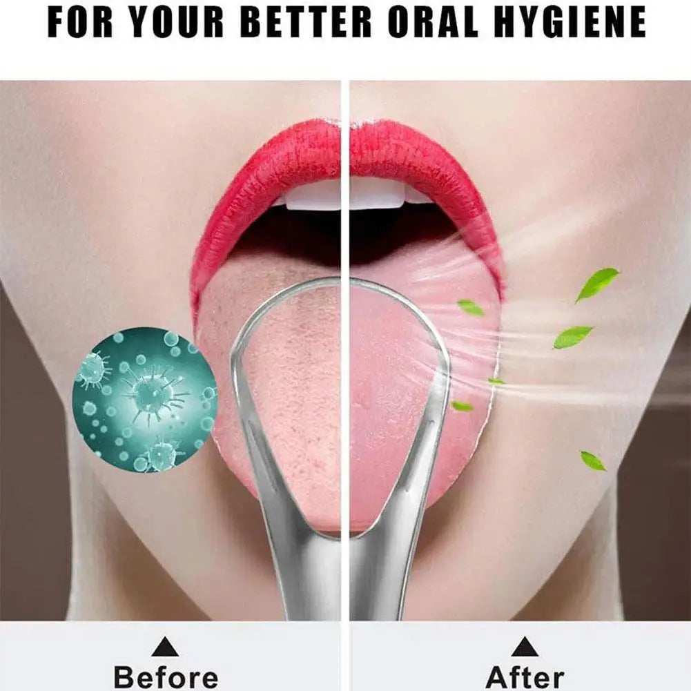 Stainless Steel Tongue Scraper | Fresh Breath Tongue Cleaner