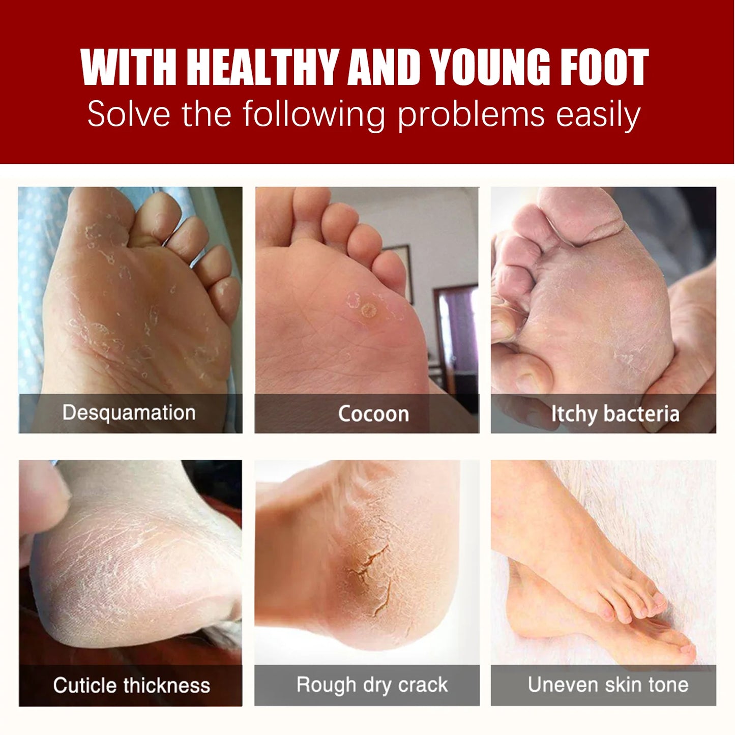 AHA Exfoliating Foot Mask – Callus & Dead Skin Remover