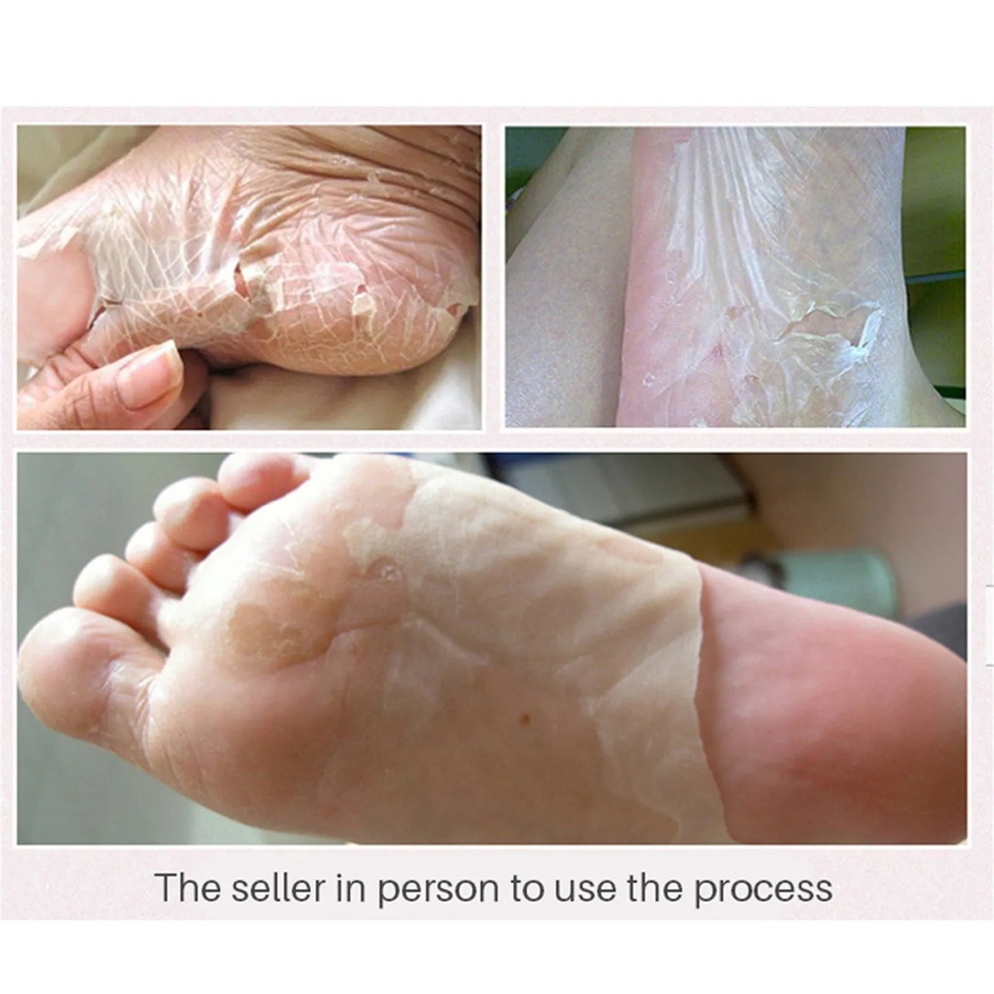 Exfoliating Foot Peel Mask | Dead Skin Remover for Soft Feet