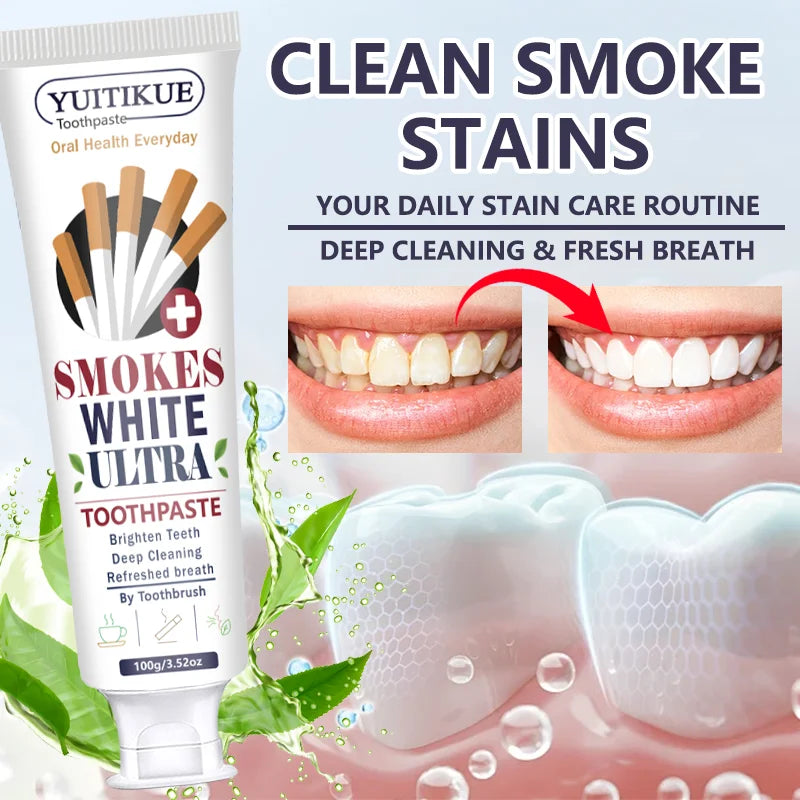 Yuitikue Smokes White Ultra Toothpaste, 100g Effective Stain Removal Toothpaste for Brighter Teeth & Fresh Breath, Deep Cleaning Peaceful Pleasures Health and Wellness