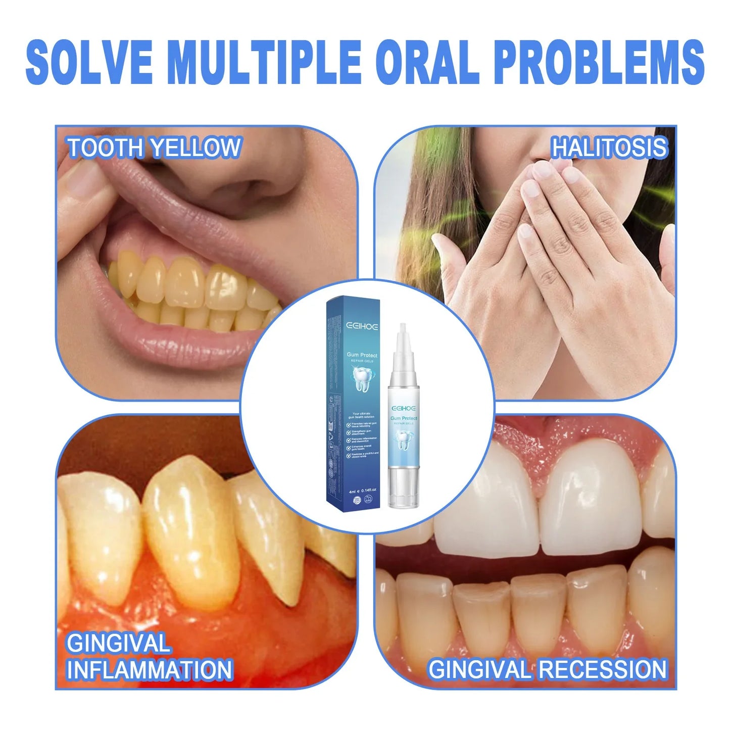 EELHOE Teeth Whitening Gel – Gum Repair & Stain Removal