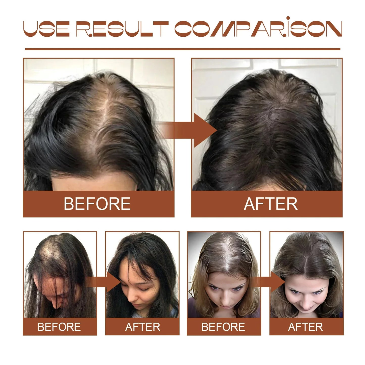 Batana Hair Growth Oil Conditioner Anti Hair Loss Products Fast Growing Hair Mask Nourishing Repair Roots Hair Care for women Peaceful Pleasures Health and Wellness