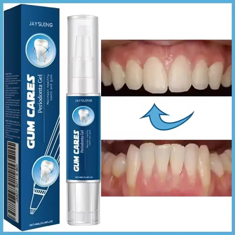 Damaged Gum Repair Care Gel Relieve Sore Gums Allergy Deep Cleaning Teeth Stains Tartar Serum Dental Caries Toothpaste Products Peaceful Pleasures Health and Wellness Damaged Gum gel