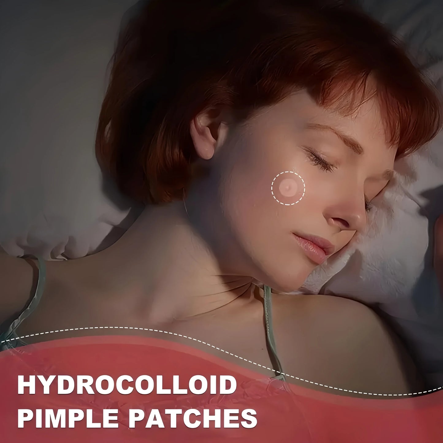 Hydrocolloid Acne Patches – Invisible, Waterproof, All Skin Types