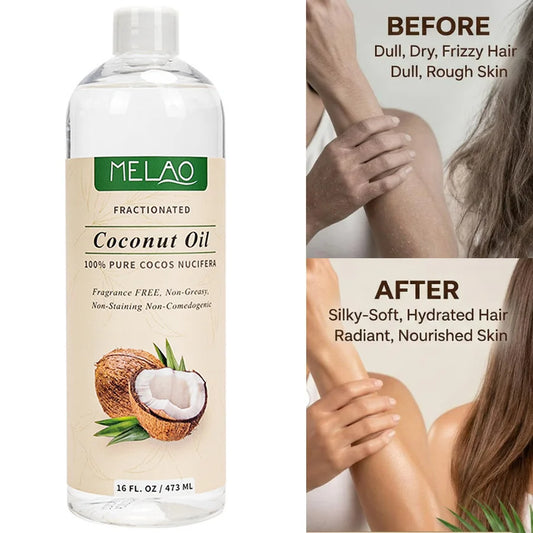 473ml Cold-Pressed Coconut Pure Essential Oil Skin Care Hair Care Soap Making DIY Making Massage Moisturize Aromatherapy Peaceful Pleasures Health and Wellness