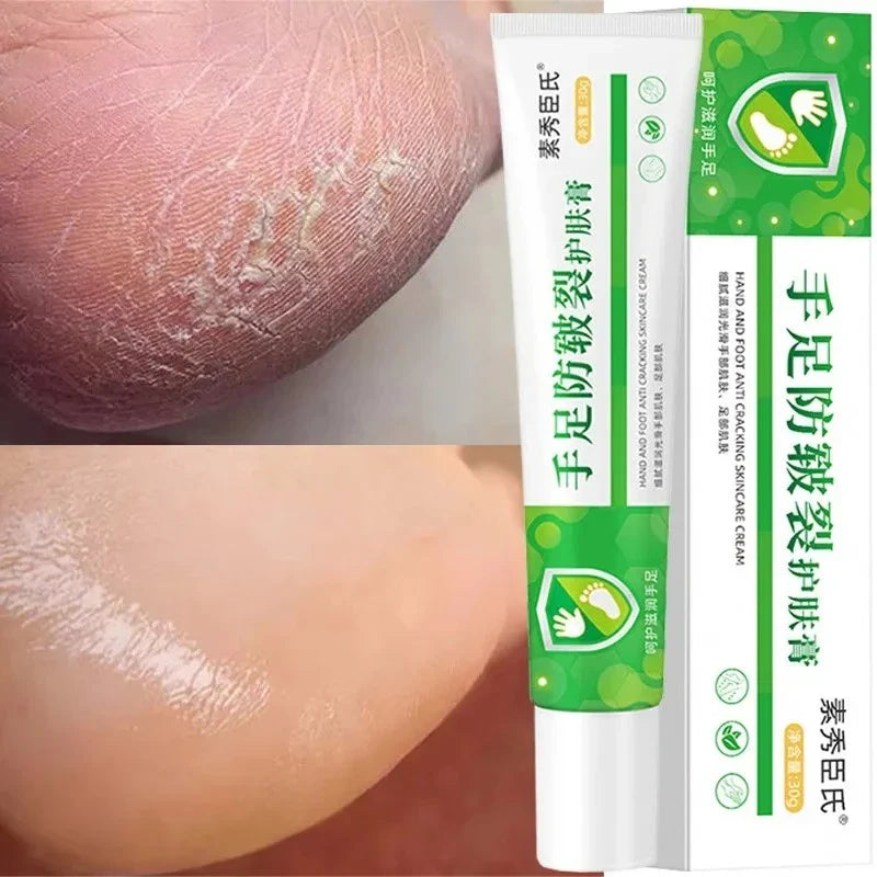 LAIKOU Herbal Foot Cream Spray – Soften & Moisturize Heels