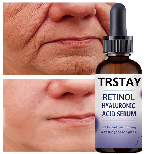 Retinol Hyaluronic Acid Serum, Gentle and Non-Irritating, Refreshing and Non-Greasy, Helps Improve Skin Condition Peaceful Pleasures Health and Wellness 20ml
