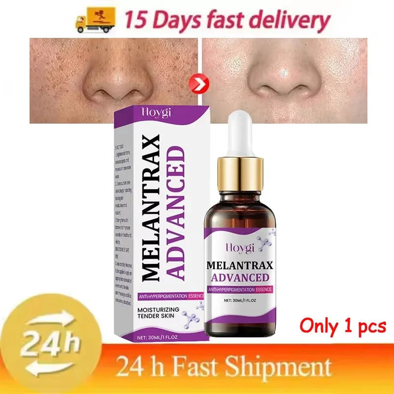 Hoygi Niacinamide Vitamin B3 Face Serum – Glow & Dark Spot Corrector