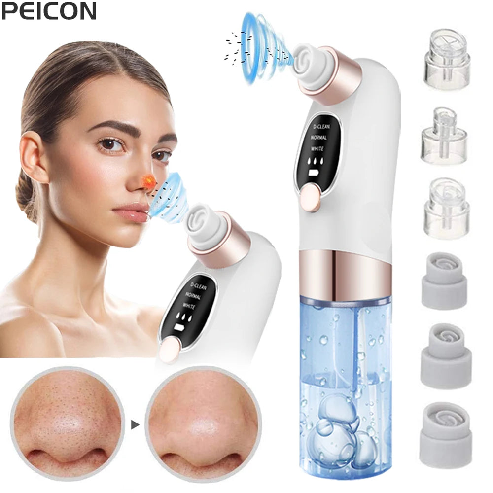 Blackhead Remover Pore Vacuum Cleaner Face Black Dot Pimple Acne Remover Electric Blackhead Vacuum Cleaner Black Point Extractor Peaceful Pleasures Health and Wellness