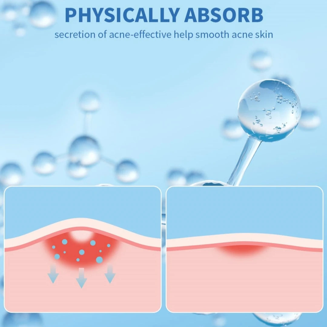 Hydrocolloid Acne Patches – Invisible, Waterproof, All Skin Types