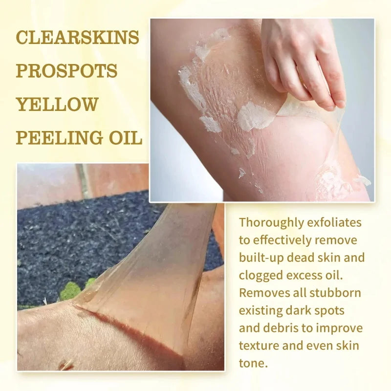 Yellow Peeling Oil – Exfoliate & Brighten Skin | 30ml