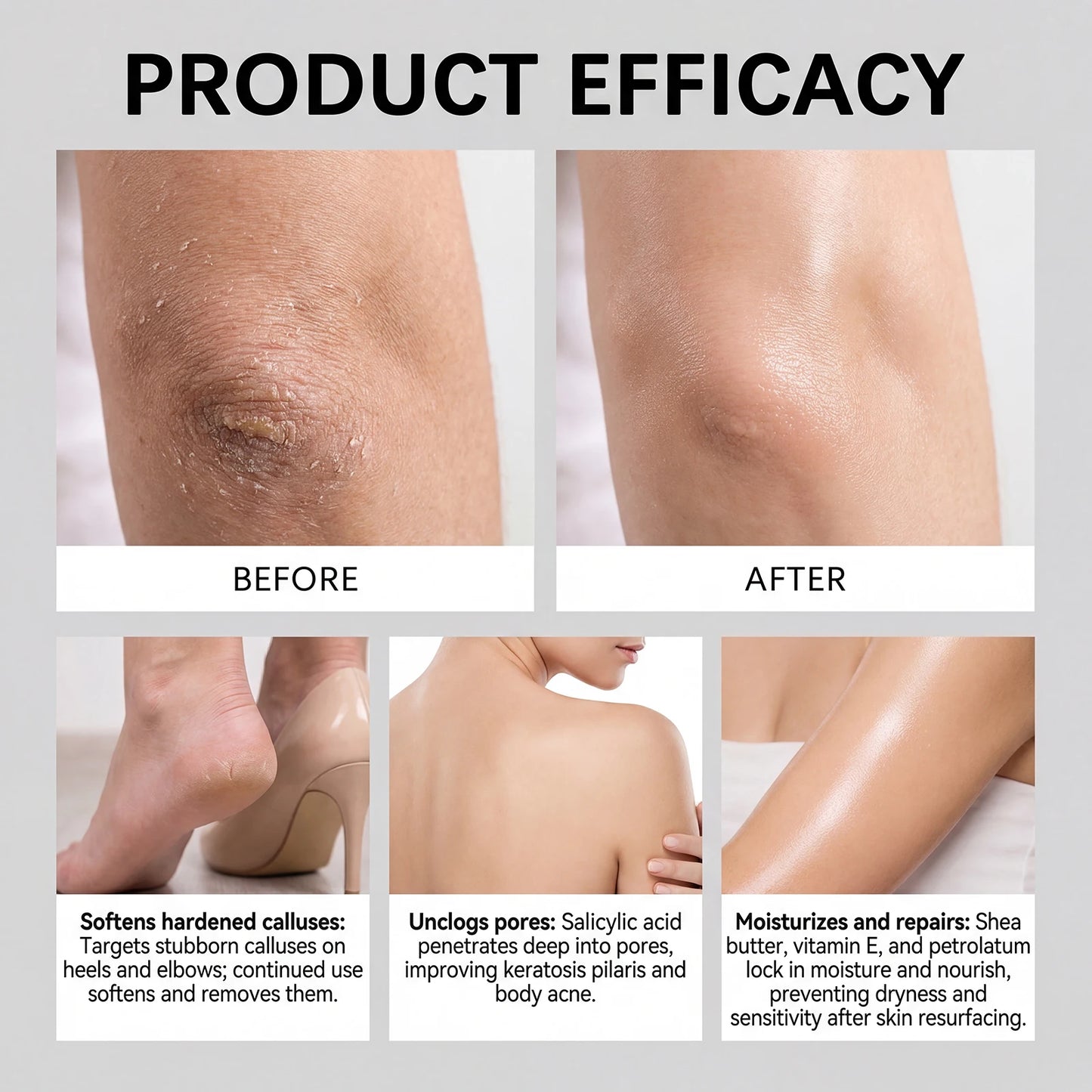 AHA BHA Exfoliating Body Stick – Shea Butter & Vitamin E 75g