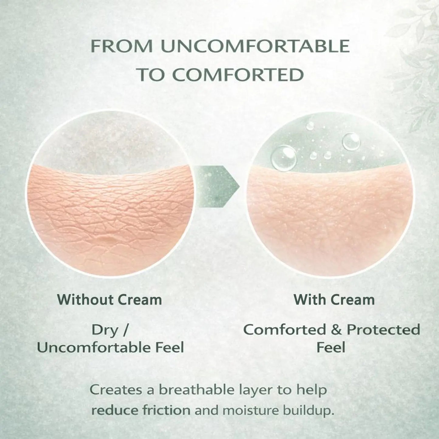 Skin Fold Soothing Cream – Intertrigo Relief & Barrier