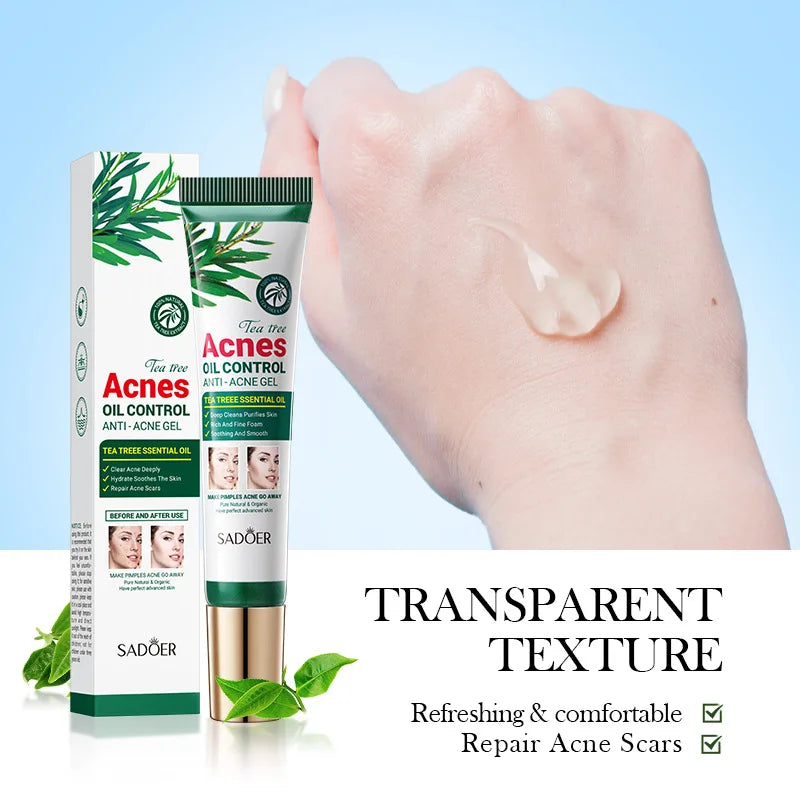 SADOER Tea Tree Acne Cream – Oil Control Hydrating Face Gel