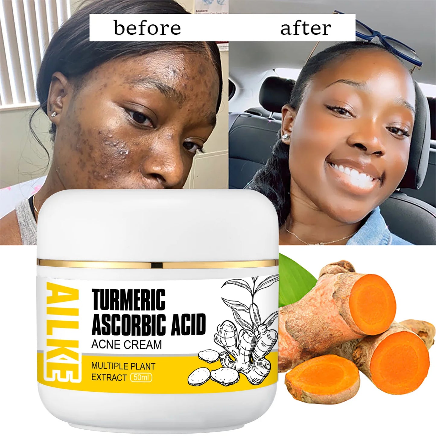AILKE Turmeric Brightening Face Cream | Glow & Clear Skin 50ml