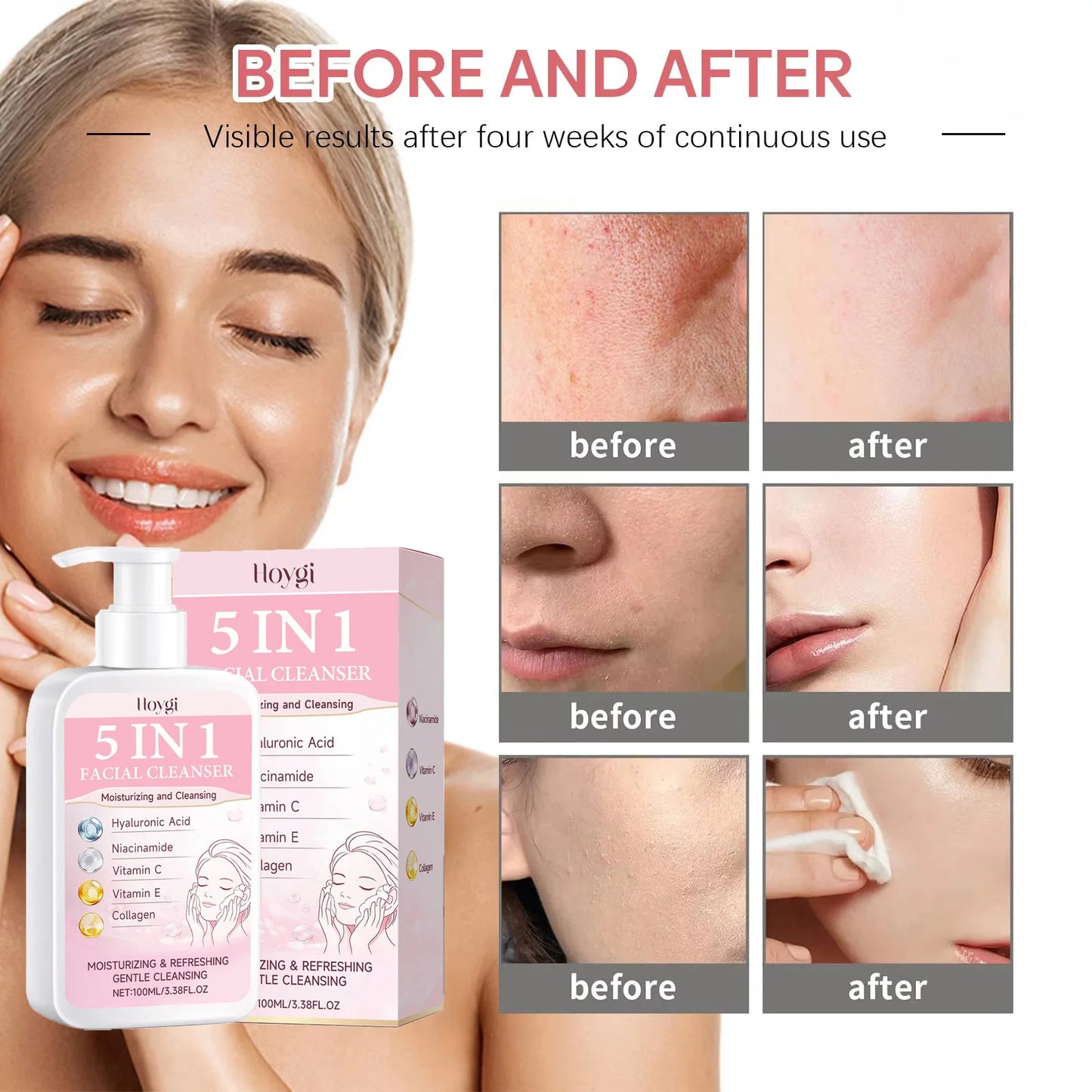 5-in-1 Hydrating Facial Cleanser – Foam, Brightening & Makeup