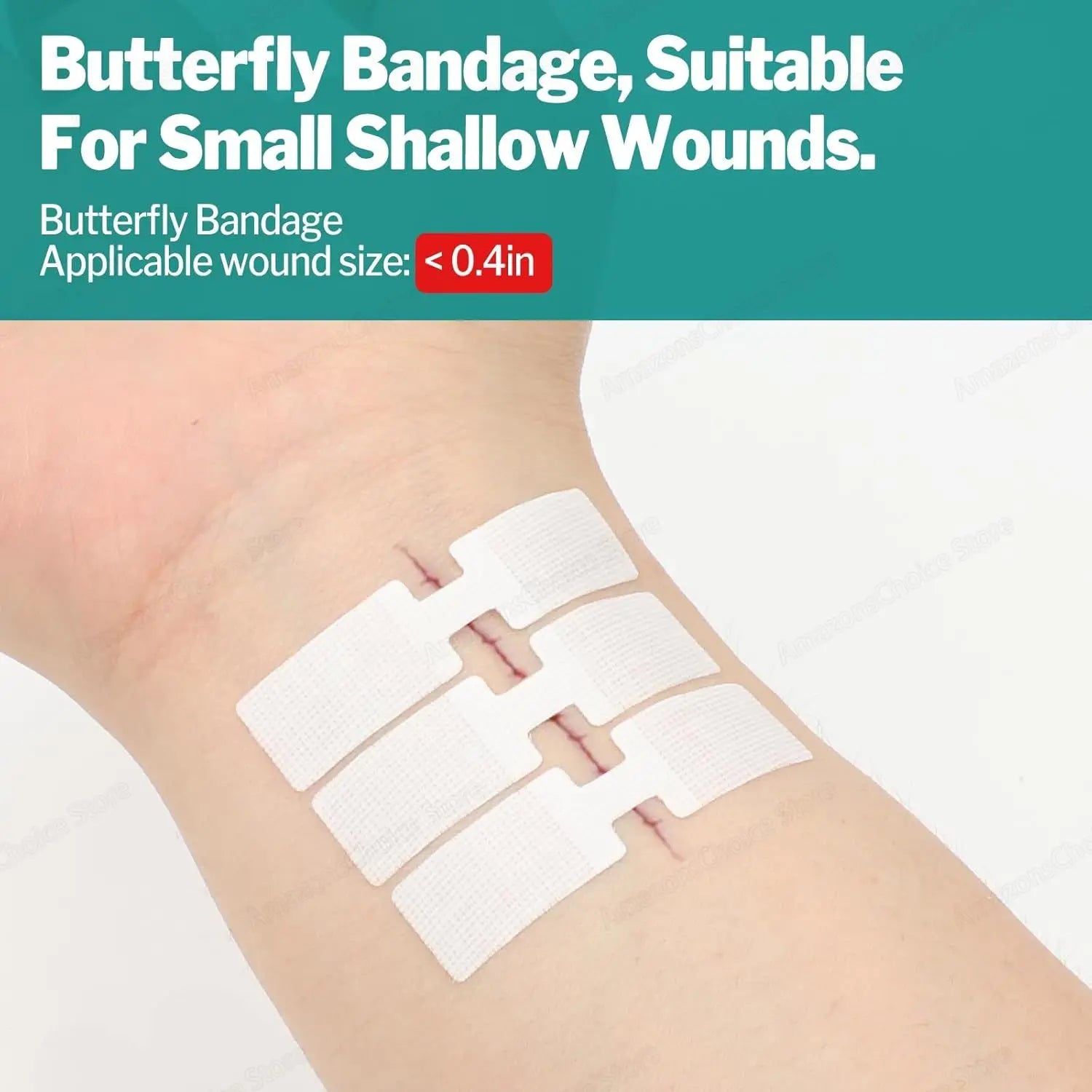Sanke rescue 14/28 Pack Wound Closure Strips Butterfly Bandages Emergency Laceration Closure Kit Repair Wounds Closures Device Peaceful Pleasures Health and Wellness
