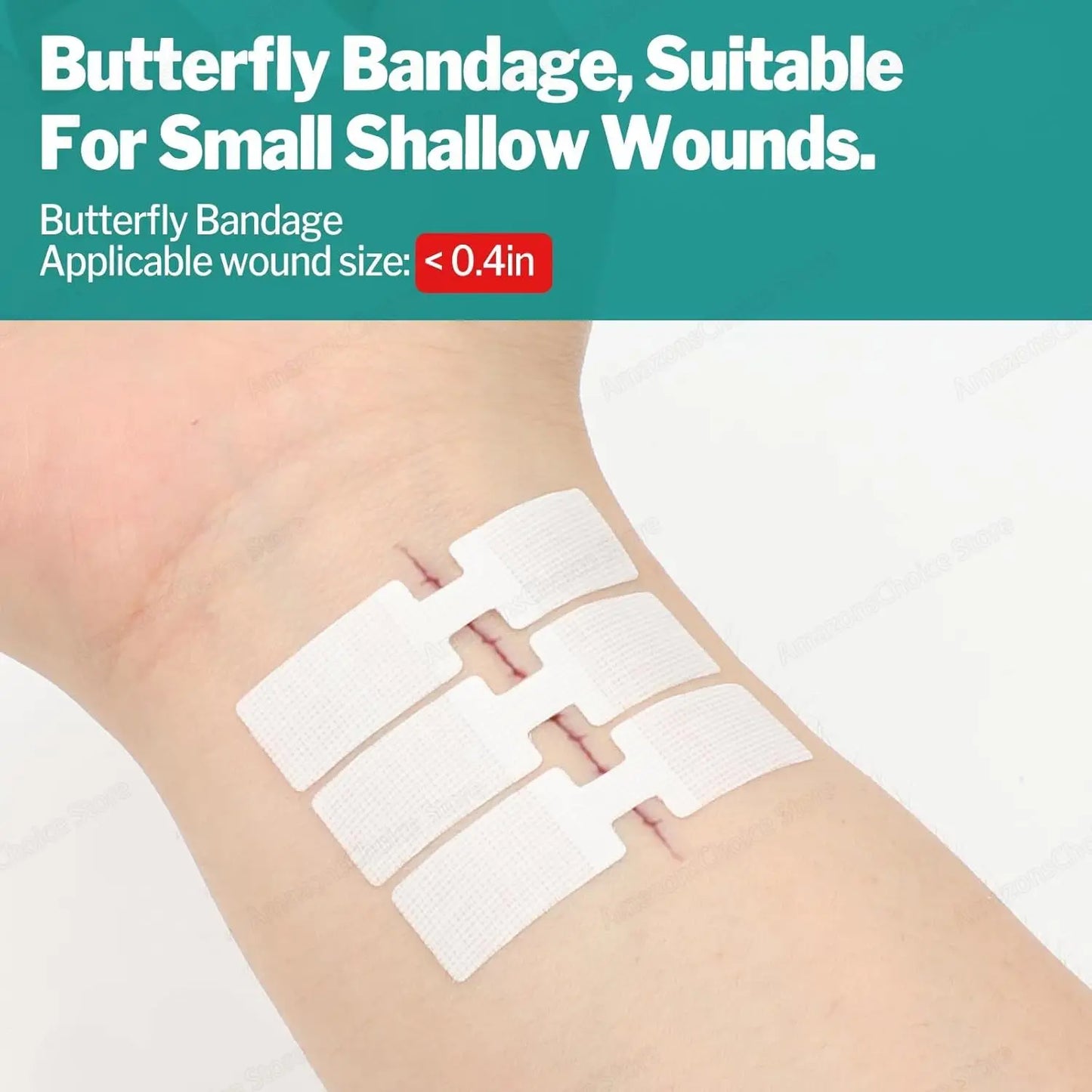 Sanke rescue 14/28 Pack Wound Closure Strips Butterfly Bandages Emergency Laceration Closure Kit Repair Wounds Closures Device Peaceful Pleasures Health and Wellness