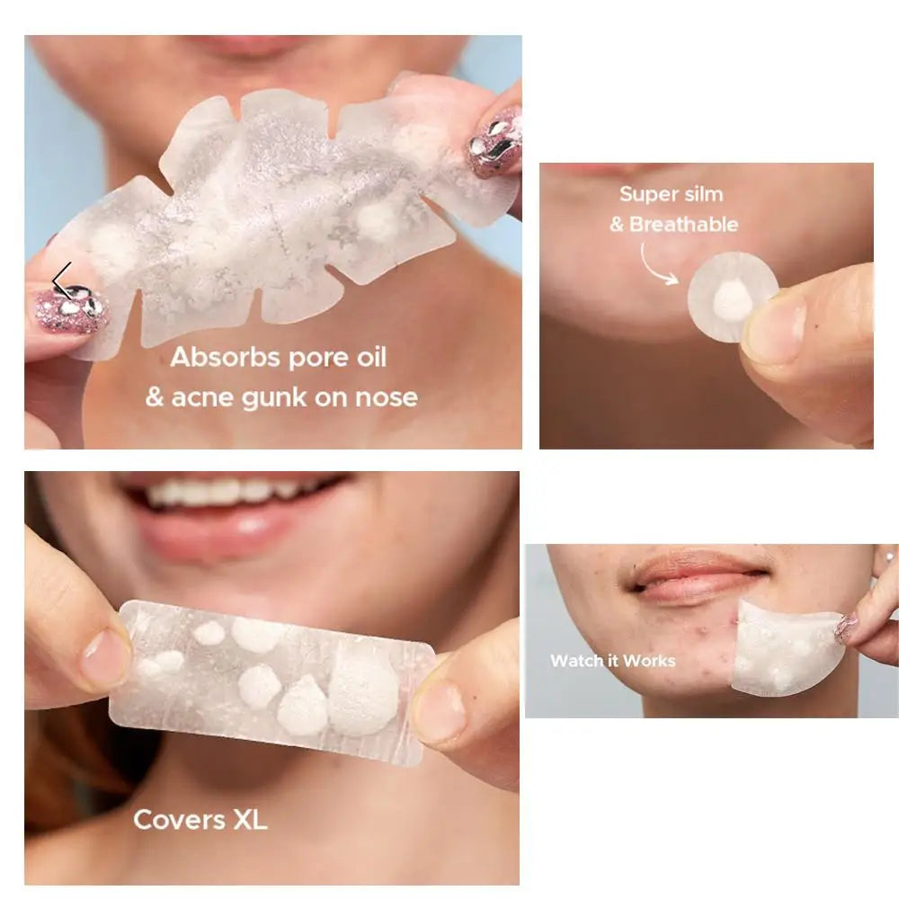 Large Pimple Patches – Hydrocolloid Acne Patches for Face & Body Peaceful Pleasures Health and Wellness