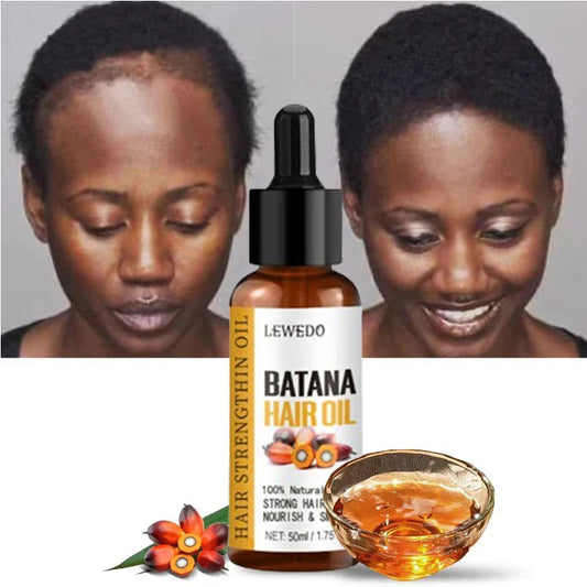 Lewedo Pure Batana Oil – Hair Growth & Nourishing Treatment 50ml Hair Treatment Oil Oasis Select