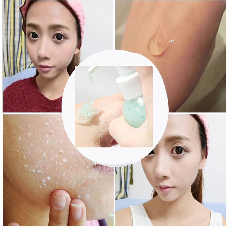 Fruit Acid Peeling Gel 120ml Facial Cleansing Exfoliating Peeling Scrub Deep Clean Acne Blackhead Remove Face Cleanser Peaceful Pleasures Health and Wellness