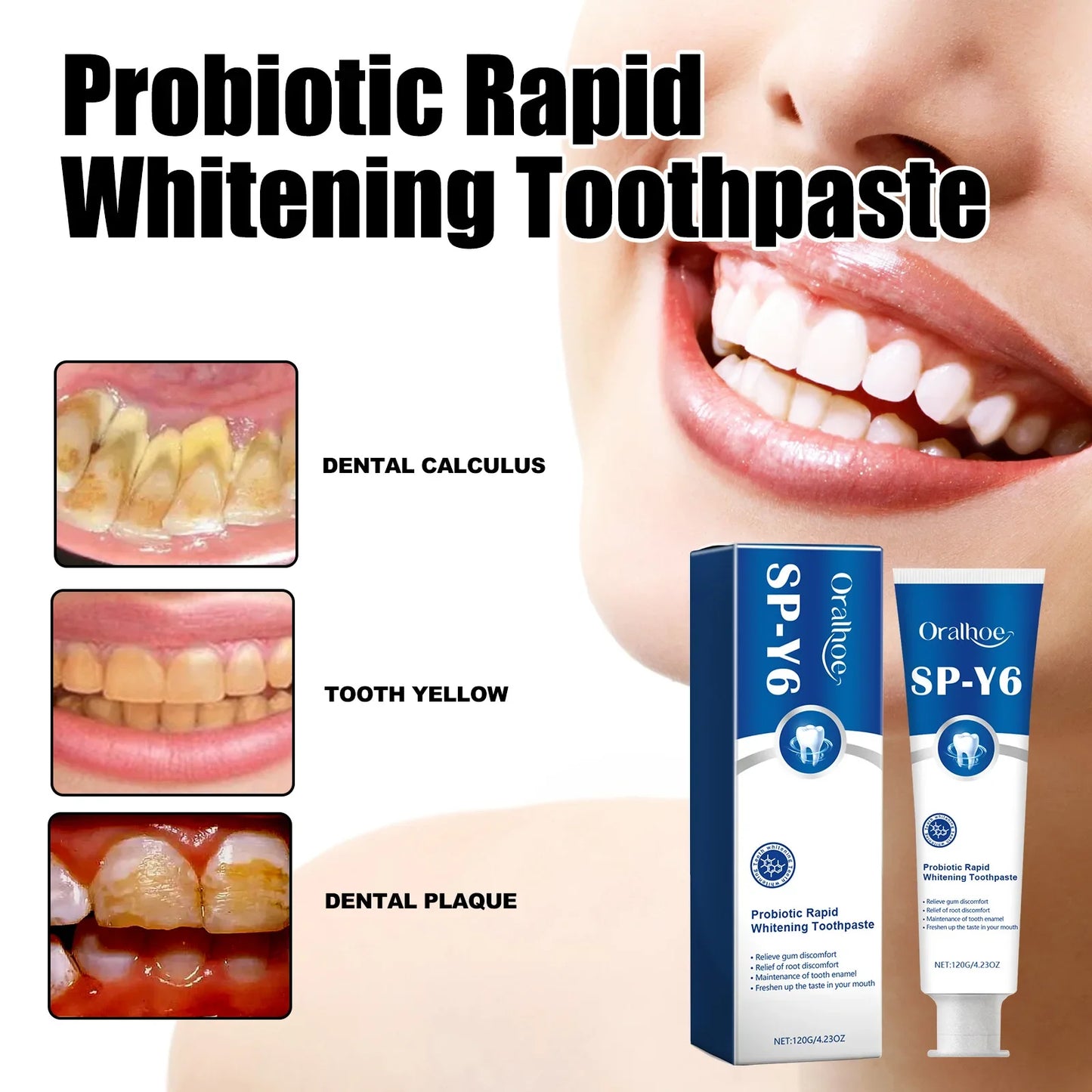 Oralhoe Probiotic Whitening Toothpaste – Fresh Breath 120g