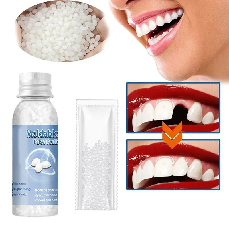 Temporary Tooth Repair Kit – Resin Denture Adhesive & Gap Filler