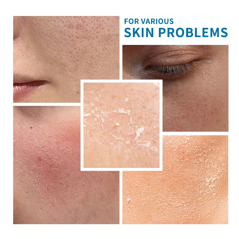 Hyaluronic Acid Skin Care Set Deeply Hydrates Solve Dry Skin Redness Easy To Be Absorbed Non-greasy Nourishes Face Skincare Set Peaceful Pleasures Health and Wellness