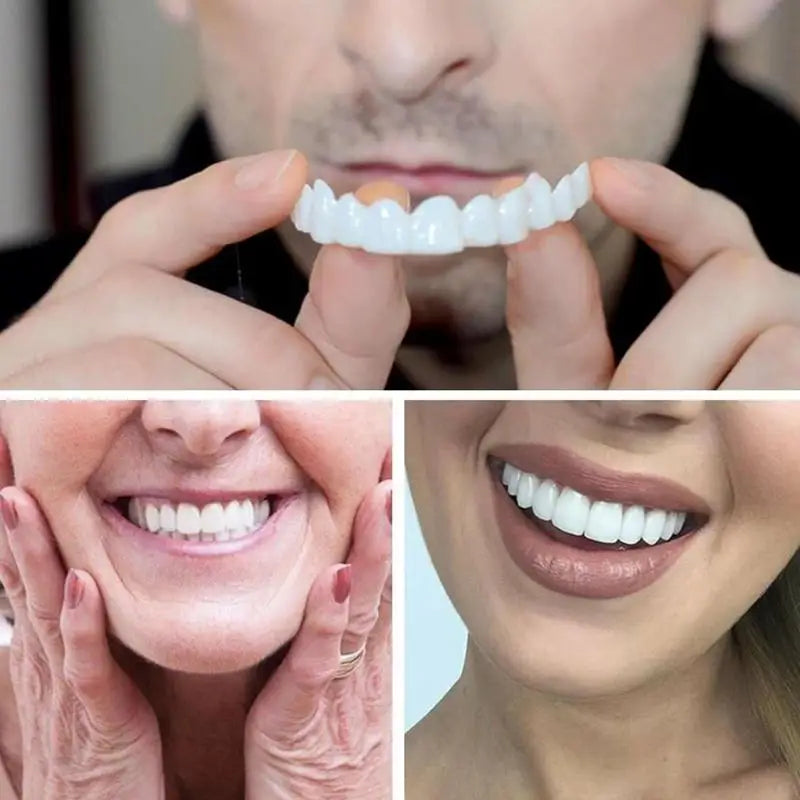 Snap-On Teeth Veneers – Reusable Smile Cover for Men & Women