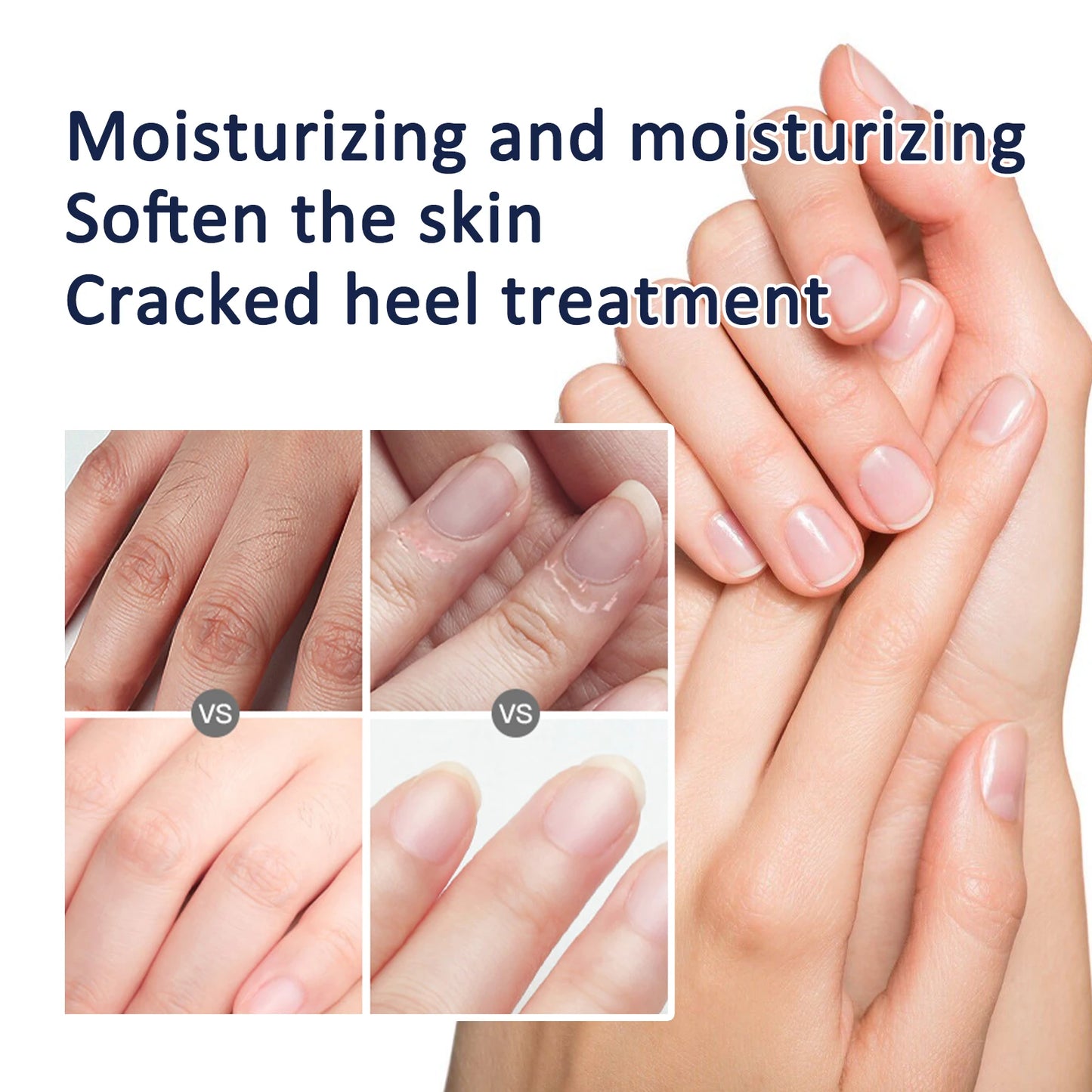 Jaysuing Shea Butter Hand & Foot Cream – Non-Greasy Moisturizer