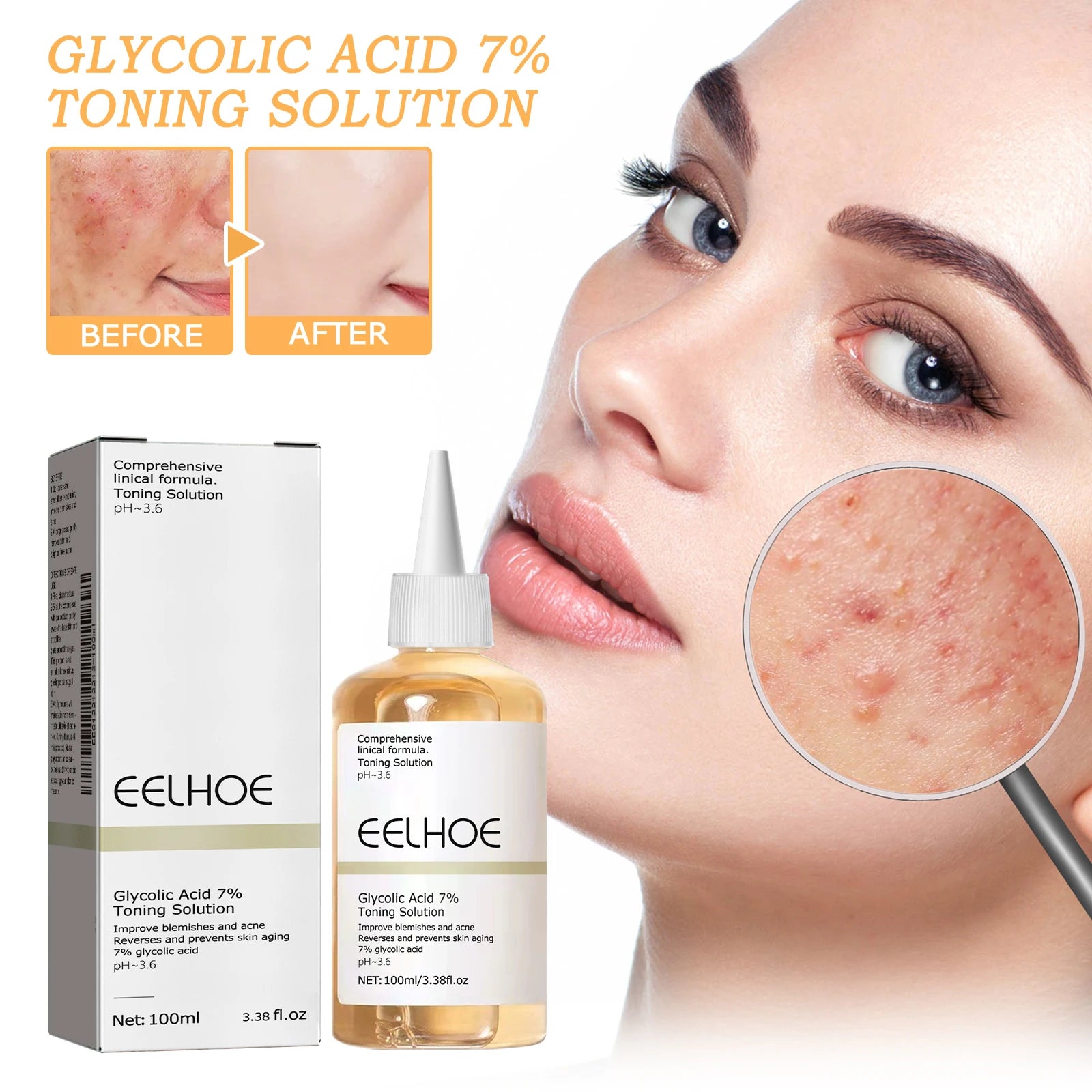 100ml Glycolic Acid Toning Solution Ordinary Acne Remover Lifting Firming Wrinkles Glowing Facial Care Gift Glycolic Acid Toner Peaceful Pleasures Health and Wellness